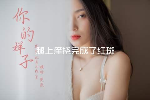 腿上痒挠完成了红斑